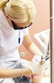 Seorang dokter melakukan prosedur fototermolisis