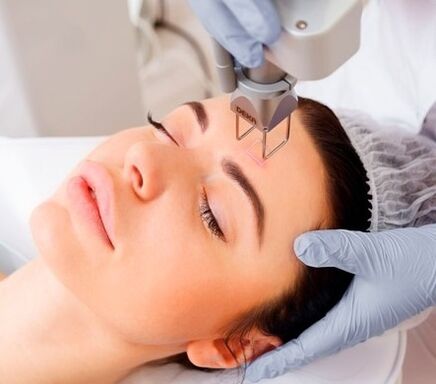 inti dari prosedur peremajaan kulit wajah laser fraksional